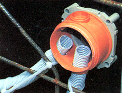  KBV
